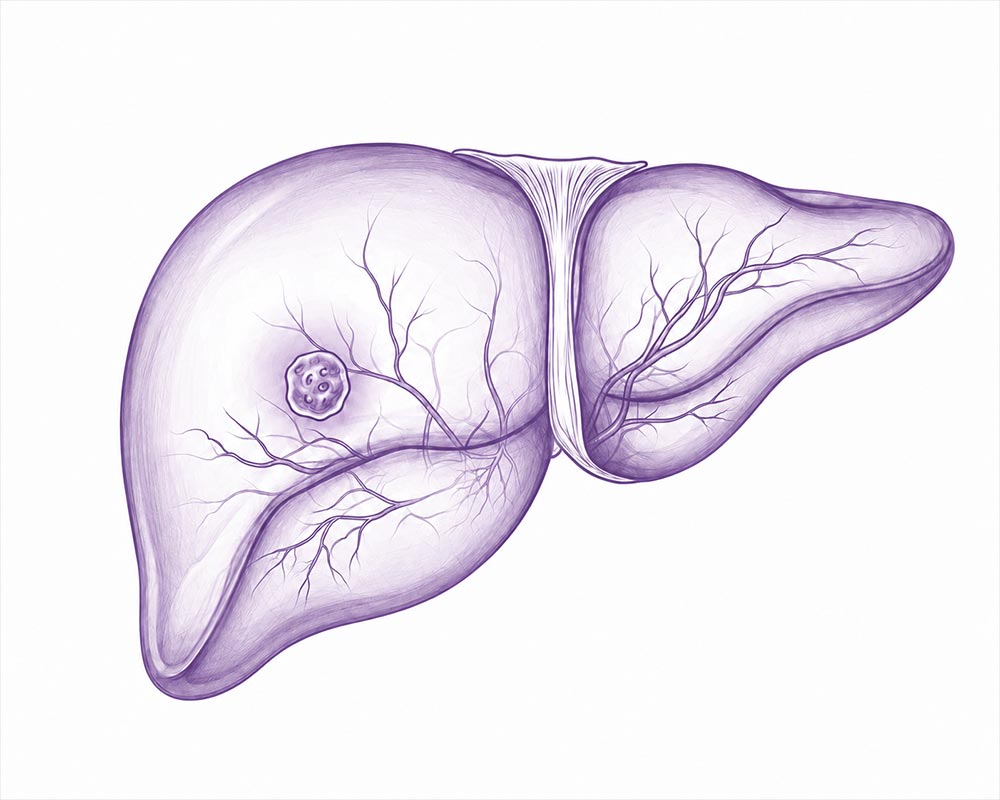 Hepatologista em BH